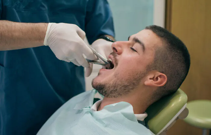 Tooth Extractions